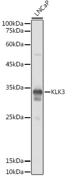 KLK3 antibody