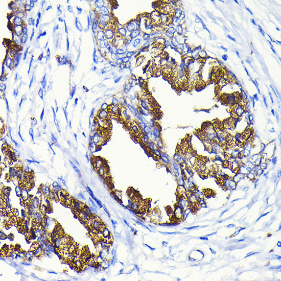 KLK3 antibody