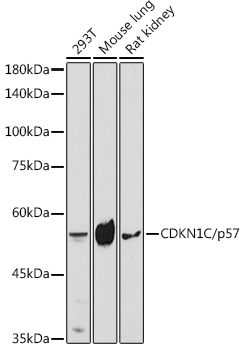 CDKN1C antibody