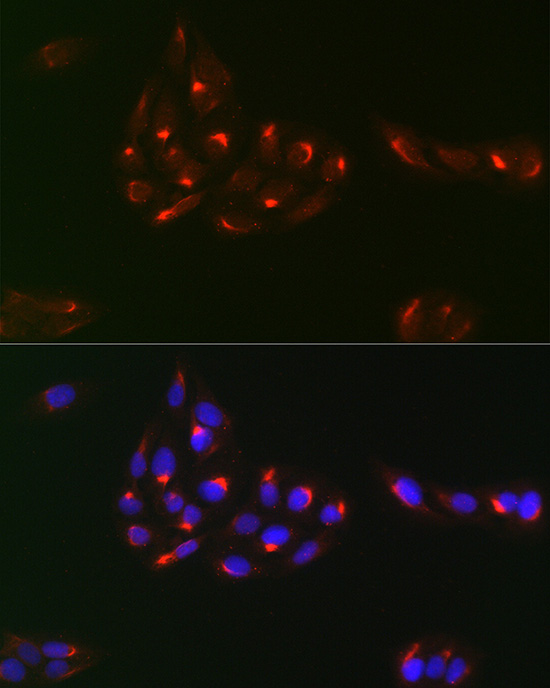 PDGFRA antibody