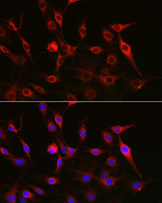 PTK2 antibody