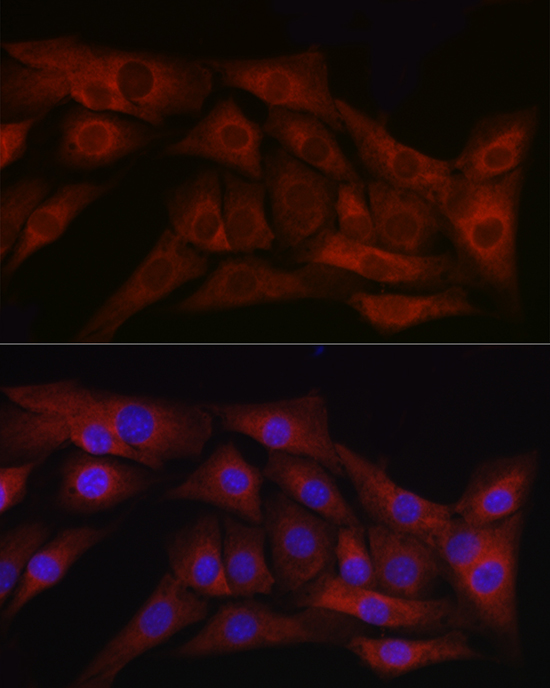 TGFB1 antibody