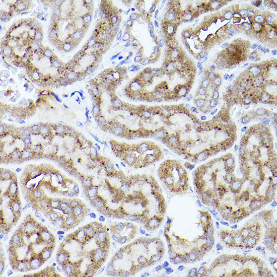 THBS1 antibody