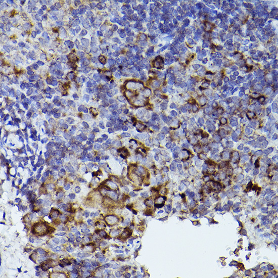 THBS1 antibody