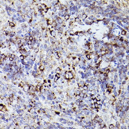 THBS1 antibody