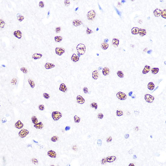 ATF2 antibody