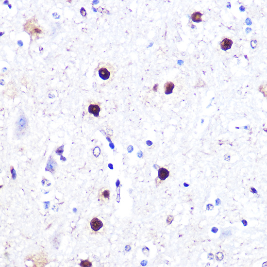 ATF2 antibody