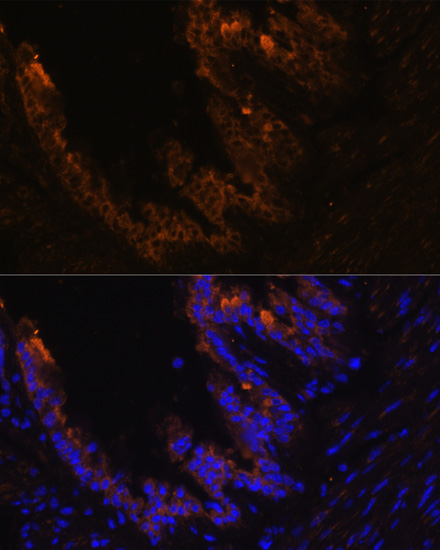 KRT7 antibody