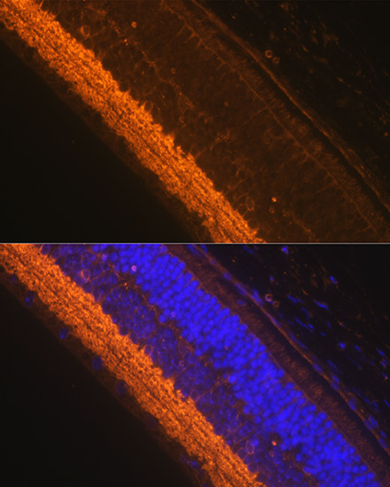 GAD1 antibody