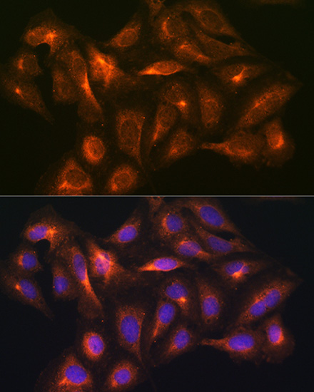 GAD1 antibody