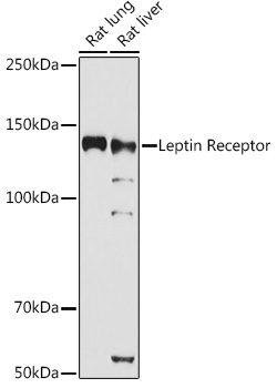 LEPR antibody - SAB | Signalway Antibody