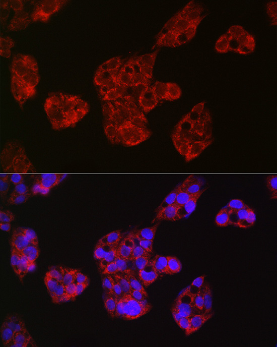 LEPR antibody