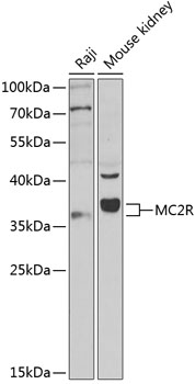 MC2R antibody