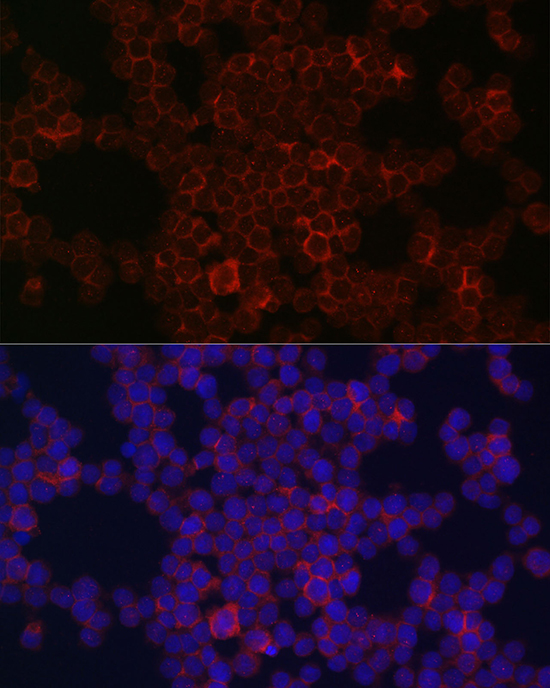 CSF1R antibody