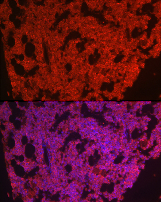 CSF1R antibody