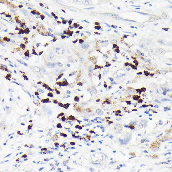 MMP8 antibody