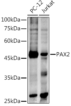 PAX2 antibody