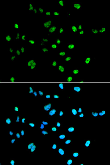 PAX2 antibody