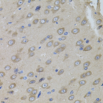 SUMO3 antibody