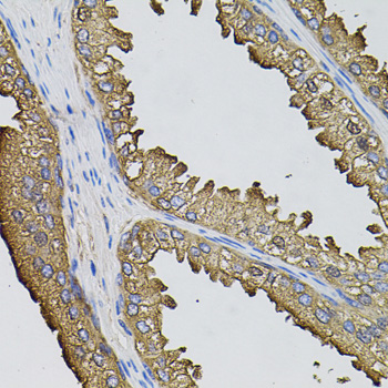 SUMO3 antibody