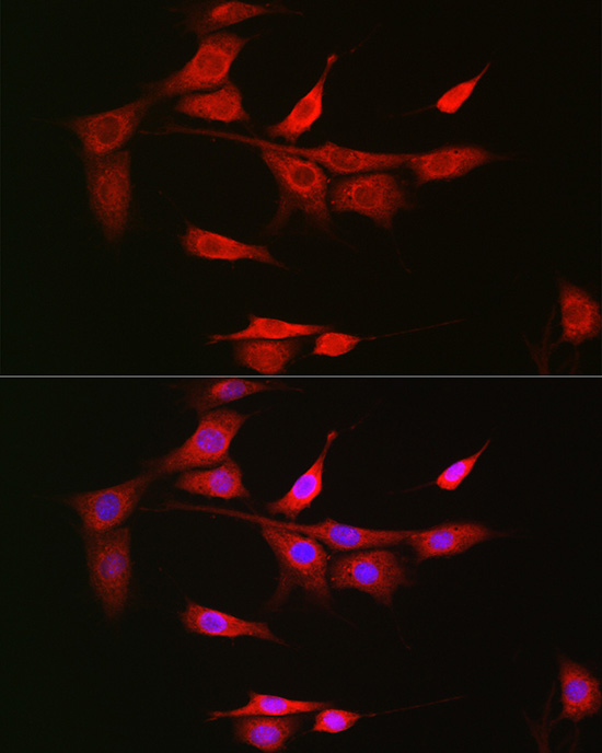 NOTCH3 antibody