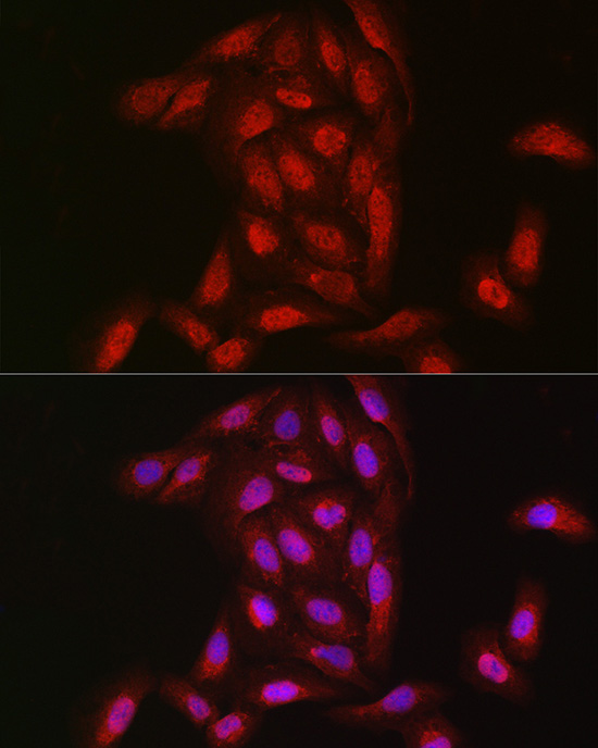 NOTCH3 antibody