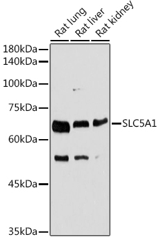 SLC5A1 antibody