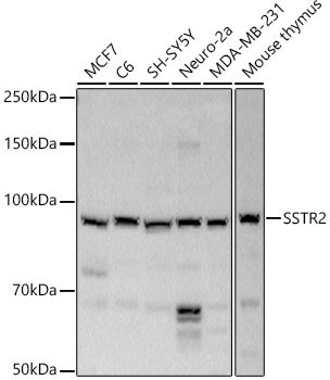 SSTR2 antibody