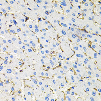 SSTR2 antibody