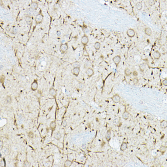 DUSP6 antibody