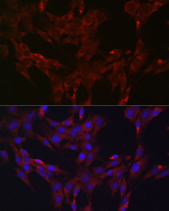 DUSP6 antibody