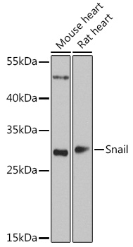 Snail antibody