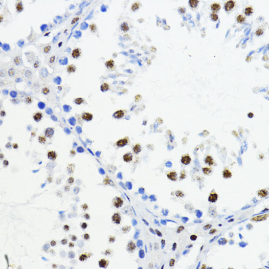 ZEB1 antibody