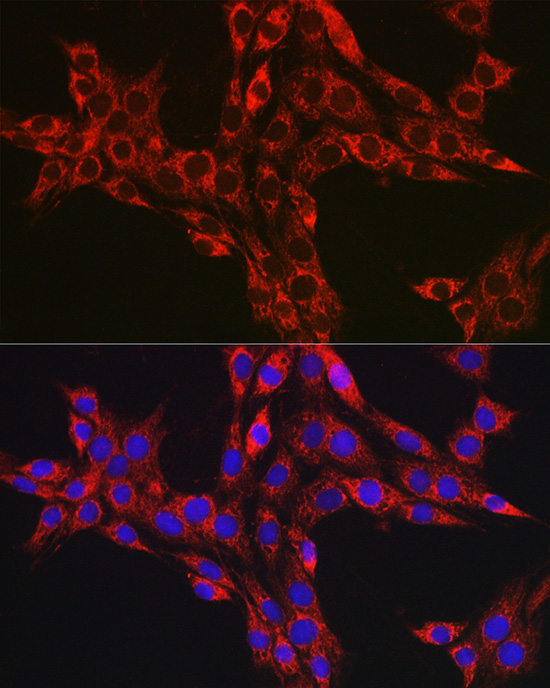 NLRP3 antibody