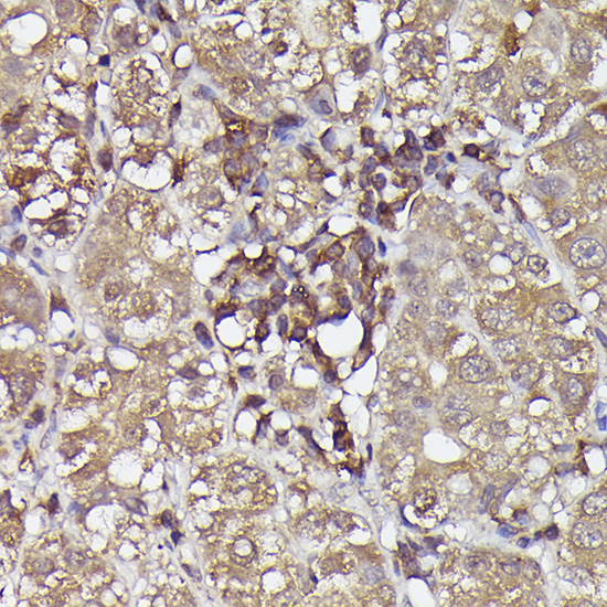 NLRP3 antibody