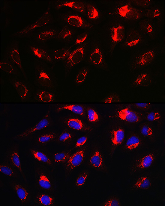 NLRP3 antibody