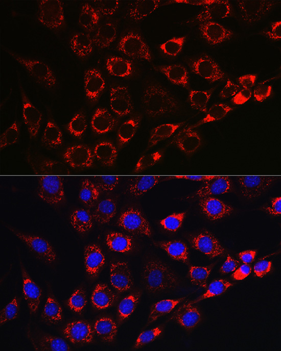 NLRP3 antibody