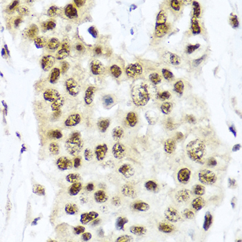 TET2 antibody