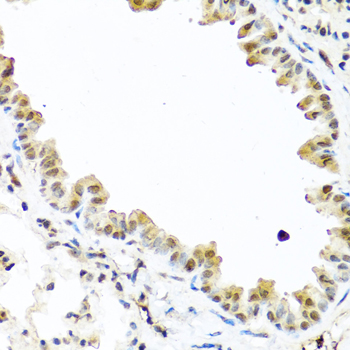 TET2 antibody