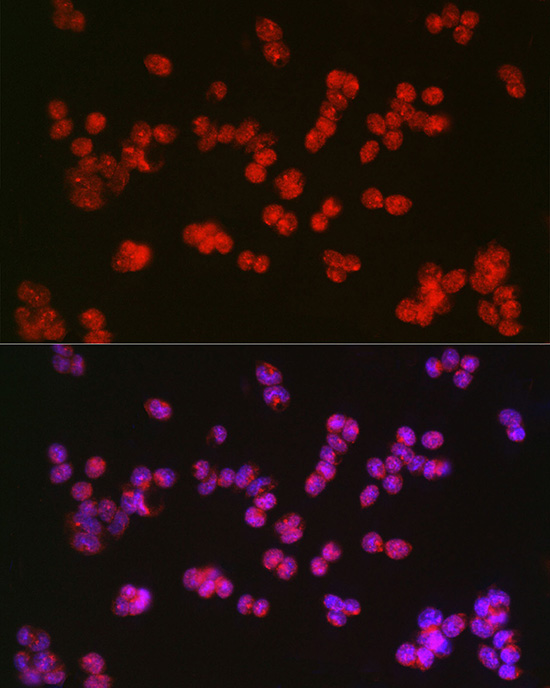 TET2 antibody