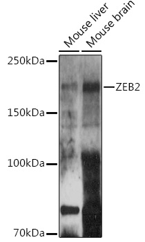 ZEB2 antibody