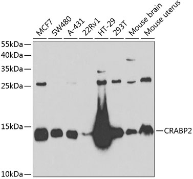 CRABP2 antibody