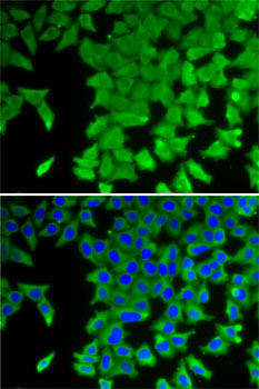 CRABP2 antibody