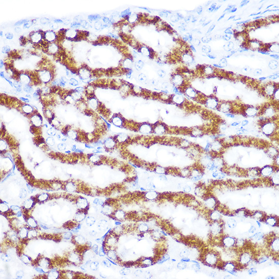 TNFRSF10D antibody