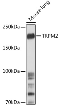 TRPM2 antibody