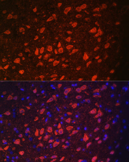 TRPM2 antibody