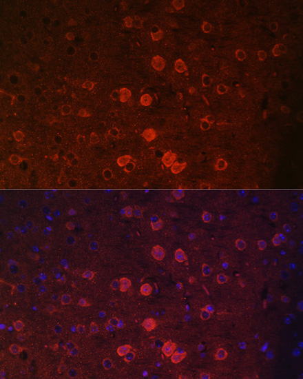 TRPM2 antibody