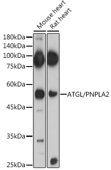 PNPLA2 antibody