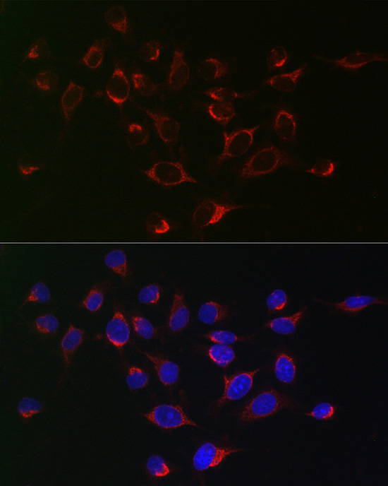 SERPINB1 antibody