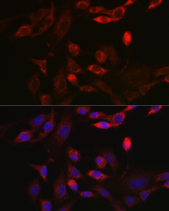 BNIP3L antibody